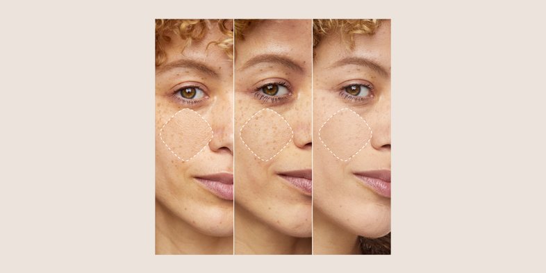 In Article How To Hide Large Pores PrimeLab